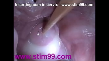 Injection Nut Nectar Jizm In Cervix Broad Spreading Cunt Cork